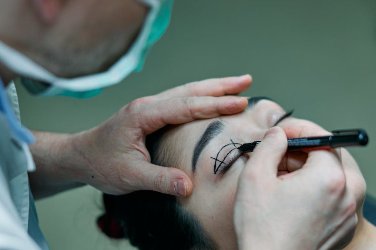 Blepharoplasty Aftercare: The Complete Eyelid Surgery Recovery Guide