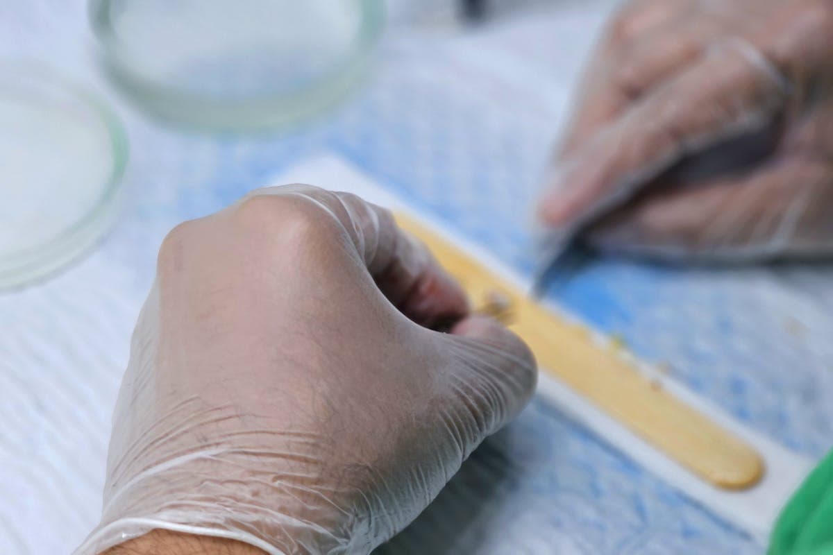 Hair Transplant Aftercare: The Complete 12-Month Recovery Guide