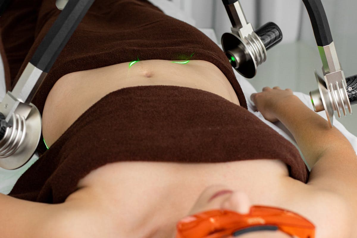 Liposuction Aftercare: The Complete Recovery Guide for Optimal Body Contouring