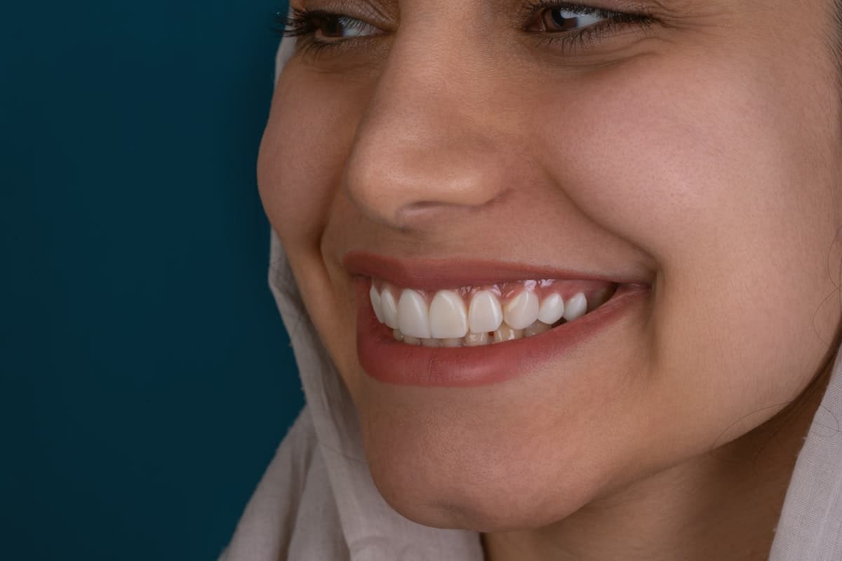 Teeth Whitening Aftercare Guide: Protect Your Brighter Smile